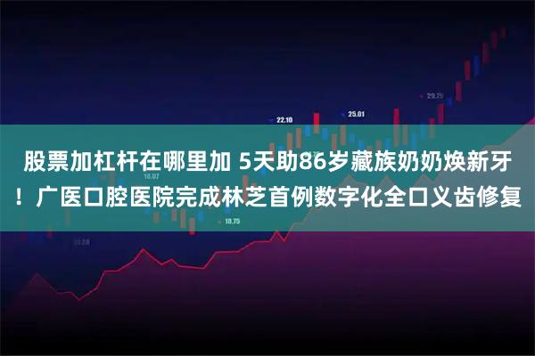 股票加杠杆在哪里加 5天助86岁藏族奶奶焕新牙！广医口腔医院完成林芝首例数字化全口义齿修复
